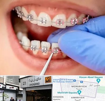 مرکز ارتودنسی دندان در منیریه
