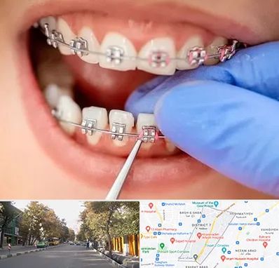 مرکز ارتودنسی دندان در شریعتی