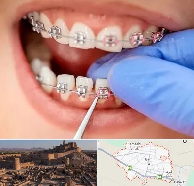 مرکز ارتودنسی دندان در بم