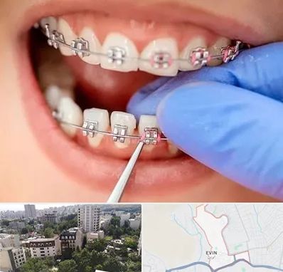 مرکز ارتودنسی دندان در اوین