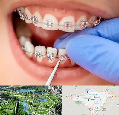 مرکز ارتودنسی دندان در بجنورد