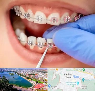مرکز ارتودنسی دندان در لاهیجان