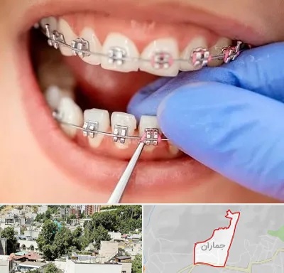 مرکز ارتودنسی دندان در جماران