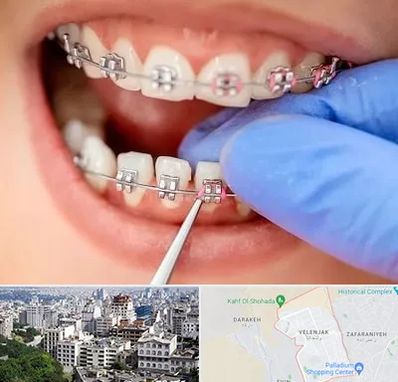 مرکز ارتودنسی دندان در ولنجک