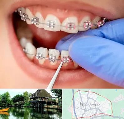 مرکز ارتودنسی دندان در صومعه سرا