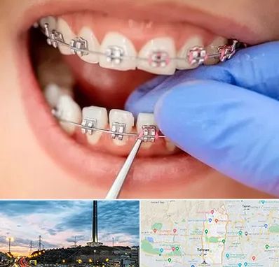 مرکز ارتودنسی دندان در منطقه 2 تهران