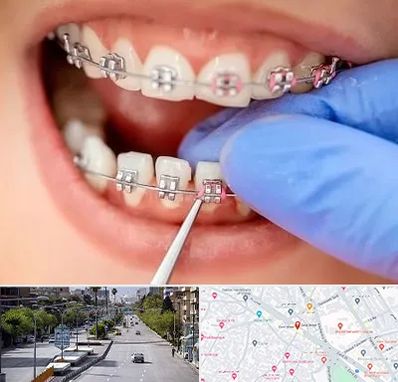 مرکز ارتودنسی دندان در خیابان زند شیراز