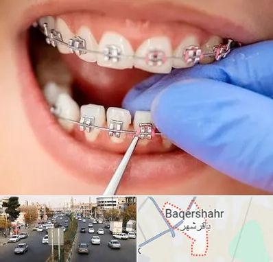 مرکز ارتودنسی دندان در باقرشهر