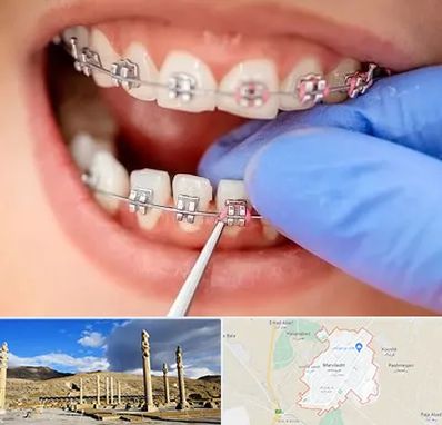 مرکز ارتودنسی دندان در مرودشت