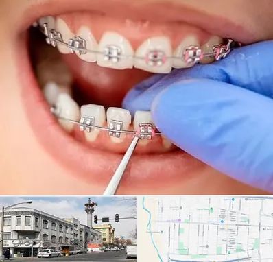 مرکز ارتودنسی دندان در 17شهریور