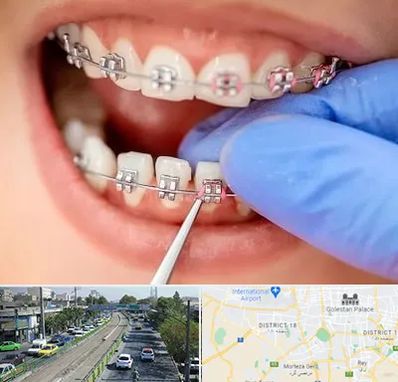 مرکز ارتودنسی دندان در جنوب تهران