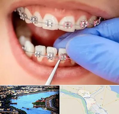 مرکز ارتودنسی دندان در خرمشهر