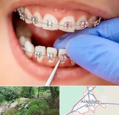 مرکز ارتودنسی دندان در آزادشهر