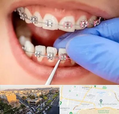 مرکز ارتودنسی دندان در تهرانپارس