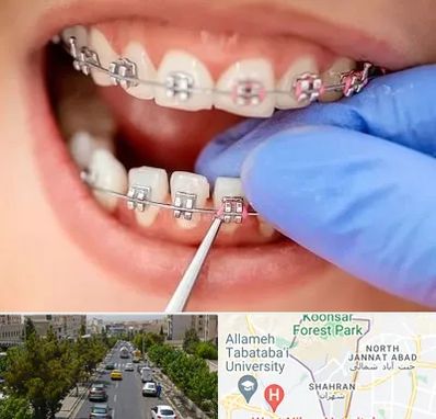 مرکز ارتودنسی دندان در شهران