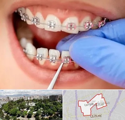 مرکز ارتودنسی دندان در نیروی هوایی