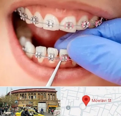 مرکز ارتودنسی دندان در مولوی