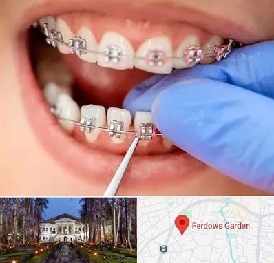 مرکز ارتودنسی دندان در باغ فردوس