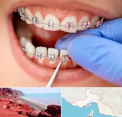 مرکز ارتودنسی دندان در هرمزگان