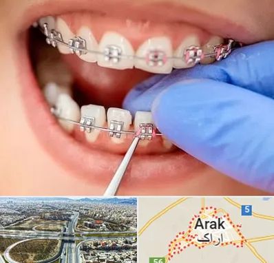 مرکز ارتودنسی دندان در اراک