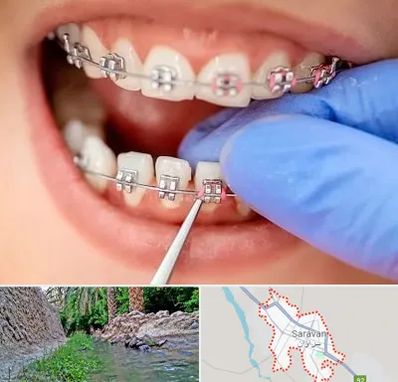 مرکز ارتودنسی دندان در سراوان