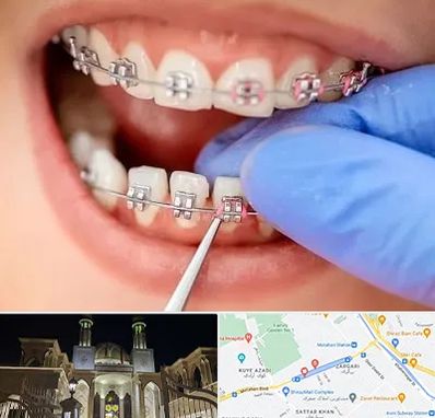 مرکز ارتودنسی دندان در زرگری شیراز