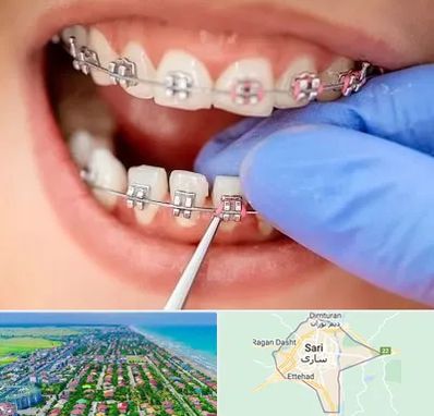 مرکز ارتودنسی دندان در ساری