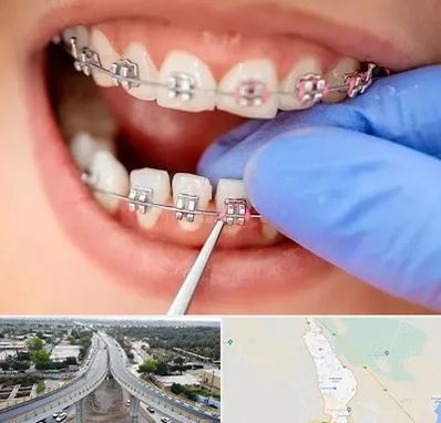 مرکز ارتودنسی دندان در اندیمشک