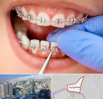 مرکز ارتودنسی دندان در محمودیه
