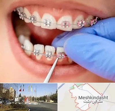 مرکز ارتودنسی دندان در مشکین دشت