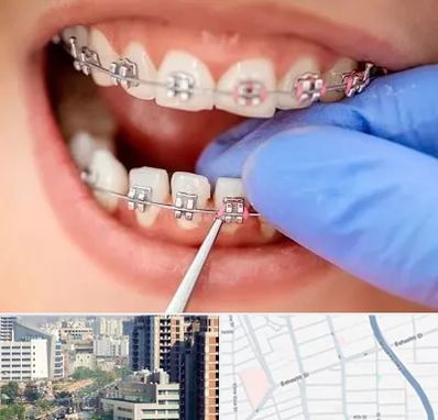 مرکز ارتودنسی دندان در خیابان بهشتی