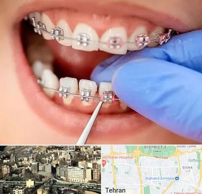 مرکز ارتودنسی دندان در مرزداران