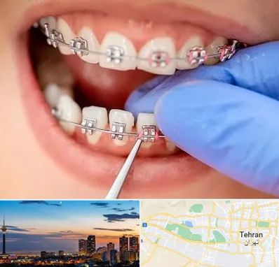 مرکز ارتودنسی دندان در غرب تهران