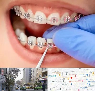 مرکز ارتودنسی دندان در فاطمی