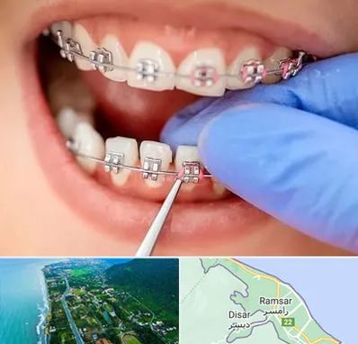 مرکز ارتودنسی دندان در رامسر