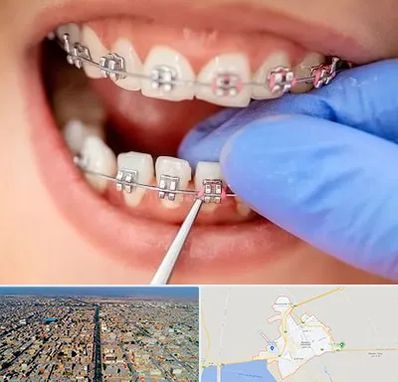 مرکز ارتودنسی دندان در بندر ماهشهر