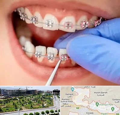 مرکز ارتودنسی دندان در پردیس