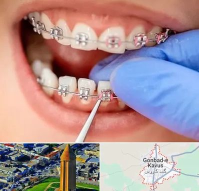 مرکز ارتودنسی دندان در گنبد کاووس