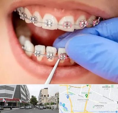 مرکز ارتودنسی دندان در بلوار فردوس