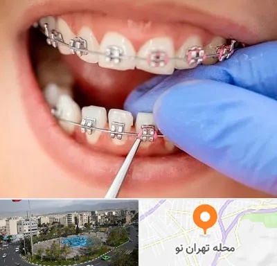 مرکز ارتودنسی دندان در تهران نو