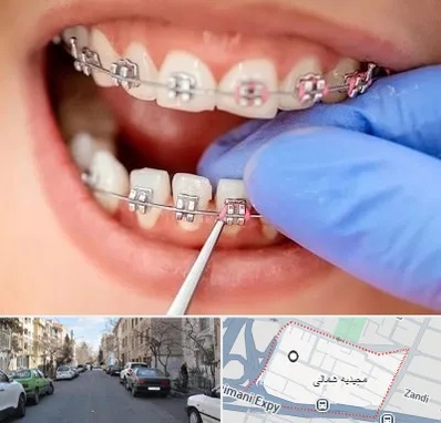 مرکز ارتودنسی دندان در مجیدیه شمالی