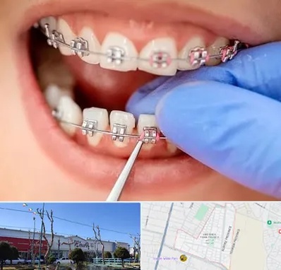 مرکز ارتودنسی دندان در فاز دو اندیشه