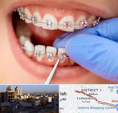 مرکز ارتودنسی دندان در فرمانیه