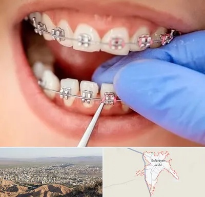 مرکز ارتودنسی دندان در اسفراین
