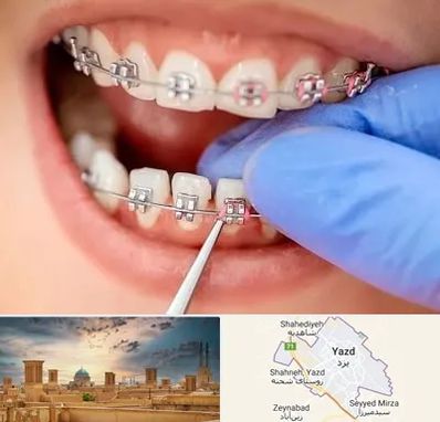 مرکز ارتودنسی دندان در یزد