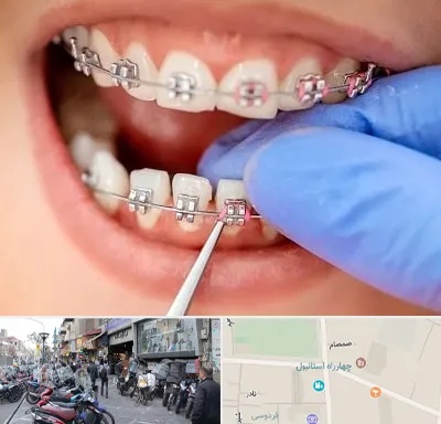 مرکز ارتودنسی دندان در چهارراه استانبول
