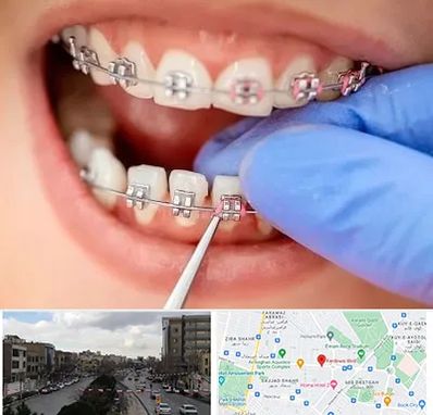 مرکز ارتودنسی دندان در بلوار فردوسی مشهد