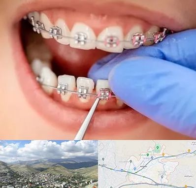 مرکز ارتودنسی دندان در رودهن