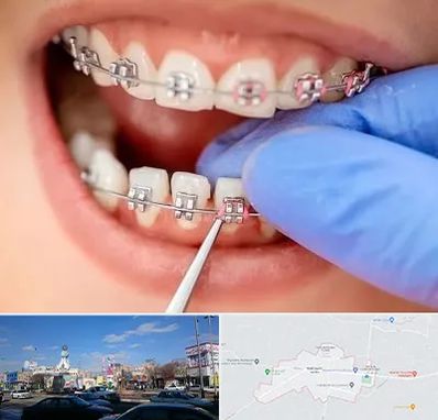 مرکز ارتودنسی دندان در ماهدشت کرج