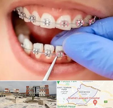 مرکز ارتودنسی دندان در حکیمیه